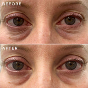 Close up of a woman's face before and after applying the Farmacy's Cheer Up vitamin c under eye cream