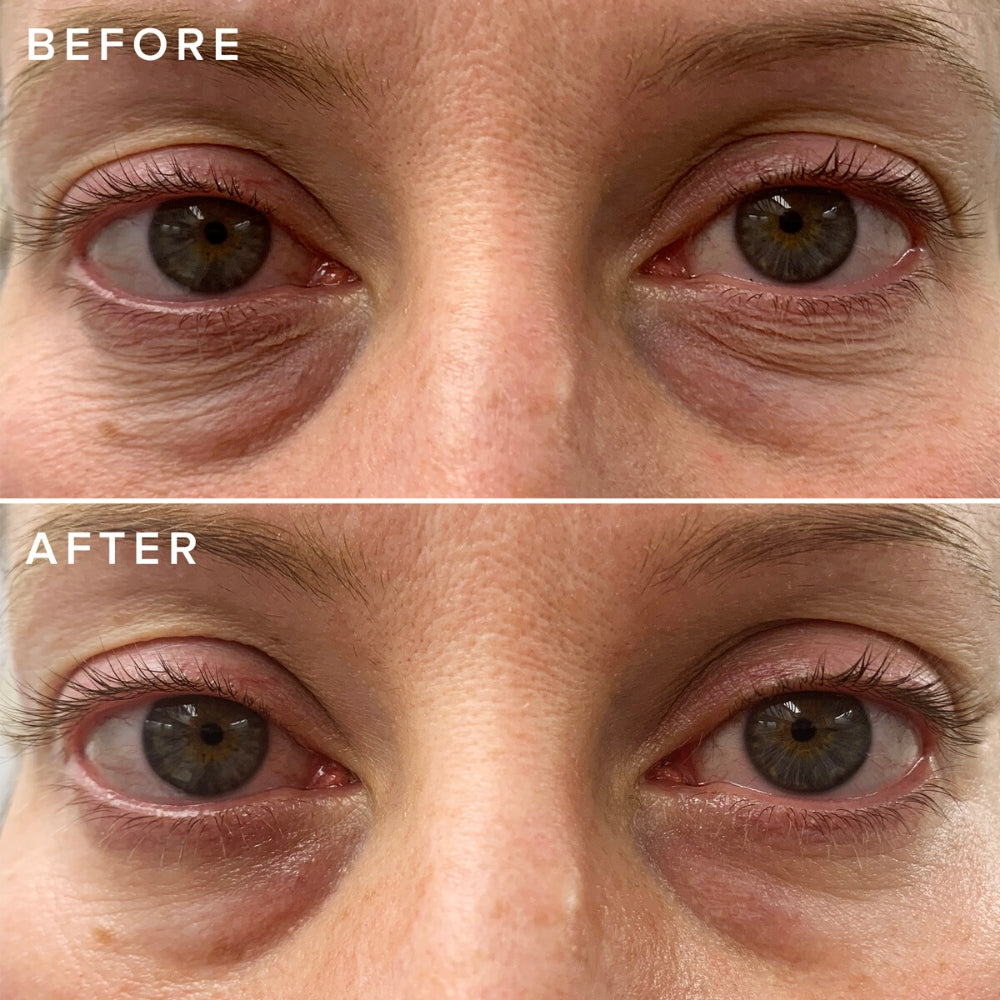 Close up of a woman's face before and after applying the Farmacy's Cheer Up vitamin c under eye cream