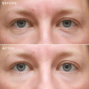Close up of a woman's face before and after applying the Farmacy's Cheer Up
