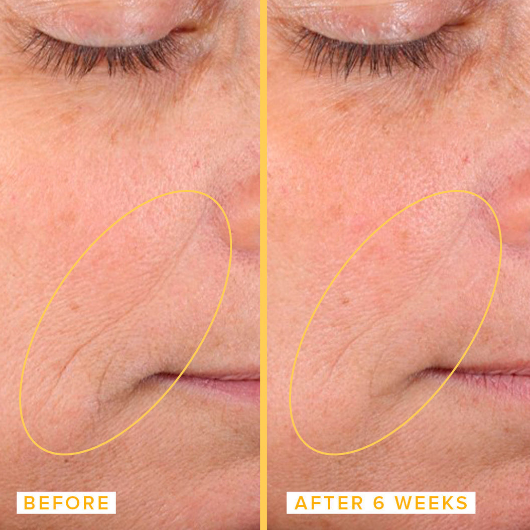 Close up of a woman's face before and after applying Farmacy's Honeymoon Glow AHA Resurfacing Night Serum