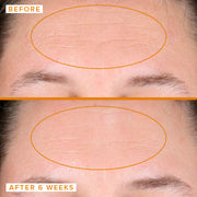 Close up of a woman's forehead before and after applying Farmacy's Honeymoon Glow for 6 weeks