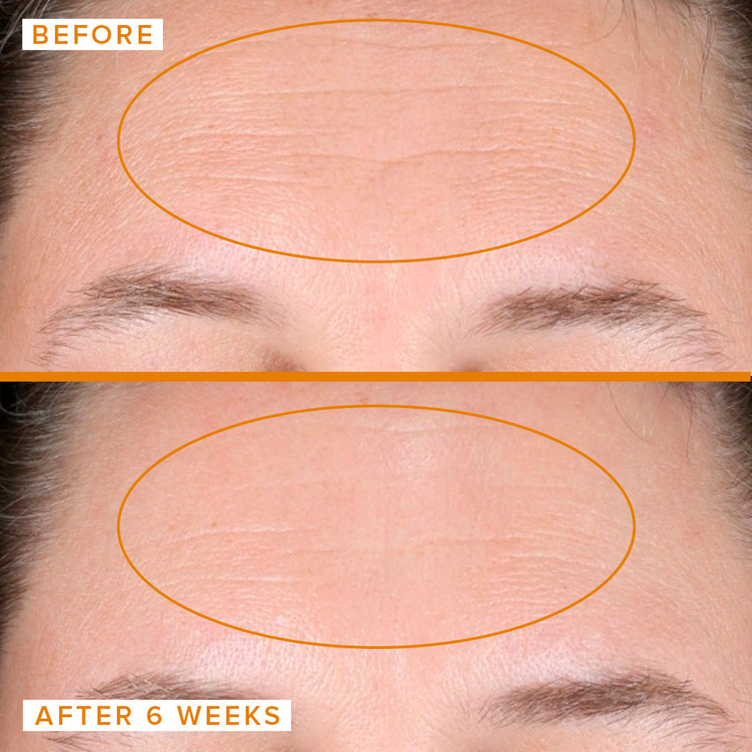 Close up of a woman's forehead before and after applying Farmacy's Honeymoon Glow for 6 weeks