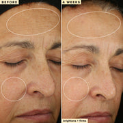 10% Waterless Vitamin C Serum Trial Size (bundle item)